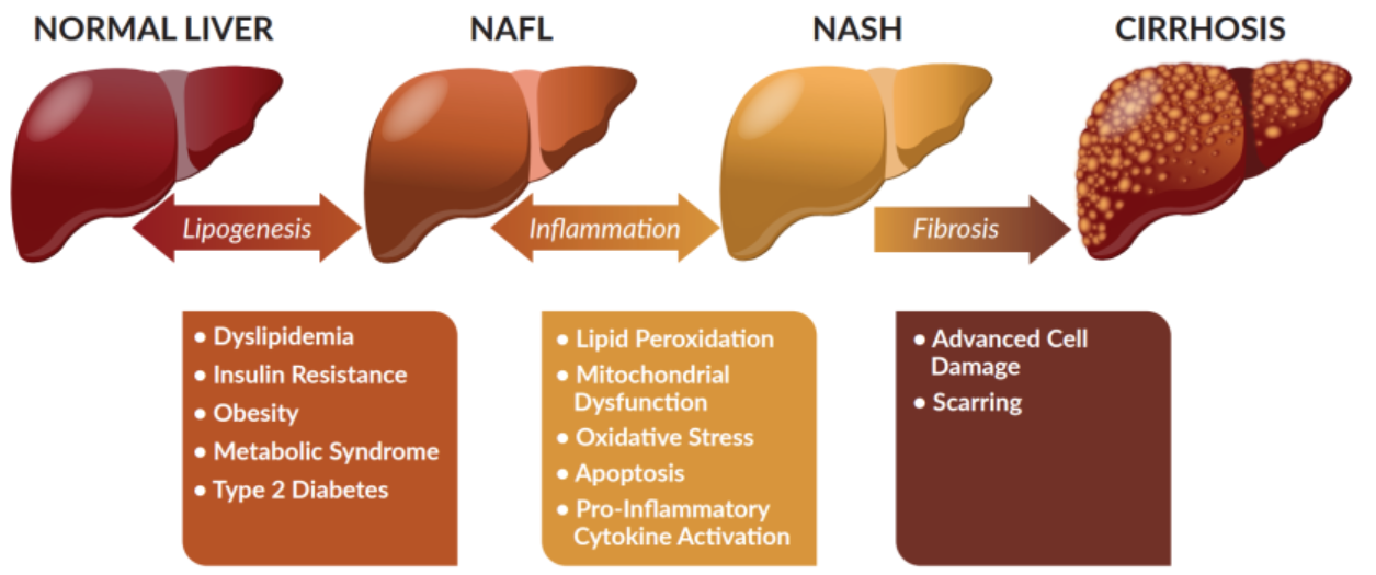 Non Alcoholic Fatty Liver Disease Nafld Healthtips By Teleme