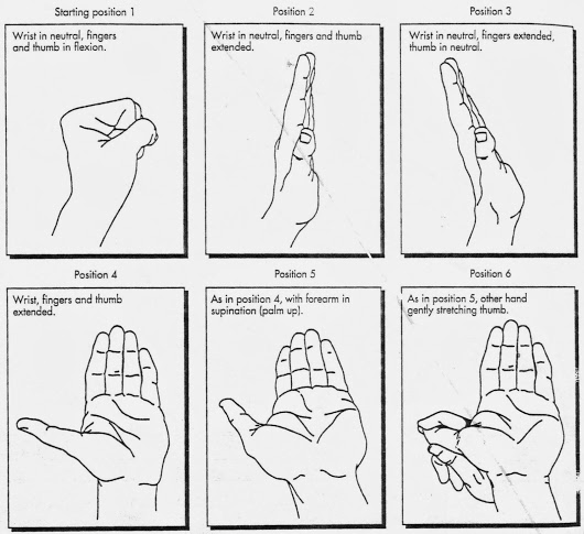 Carpal tunnel exercises before surgery