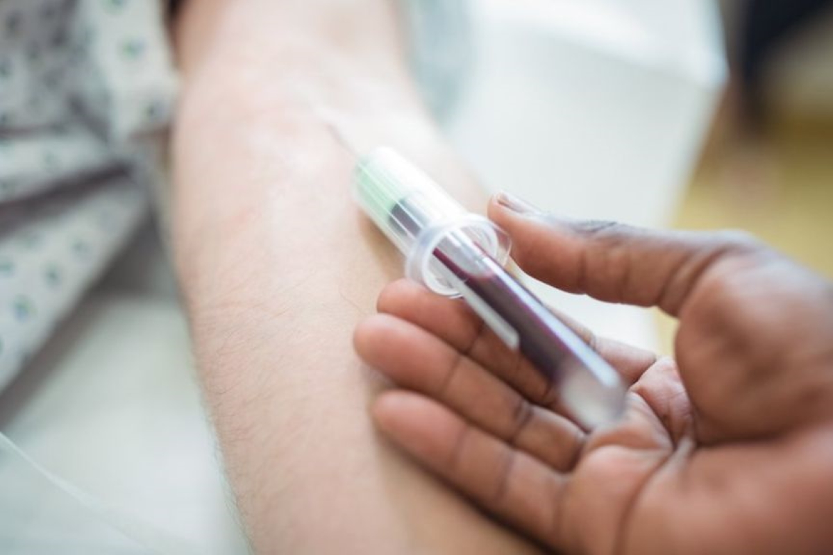 Why do you Need to Monitor your Blood Test
