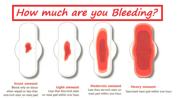 Heavy Menstrual Bleeding - Healthtips by TeleMe