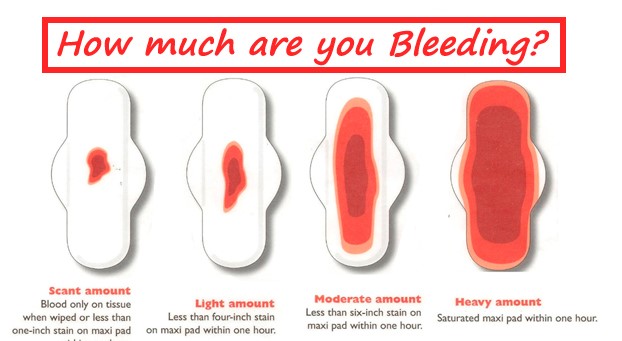 What is Heavy Period Flow? Is Heavy Flow Normal?