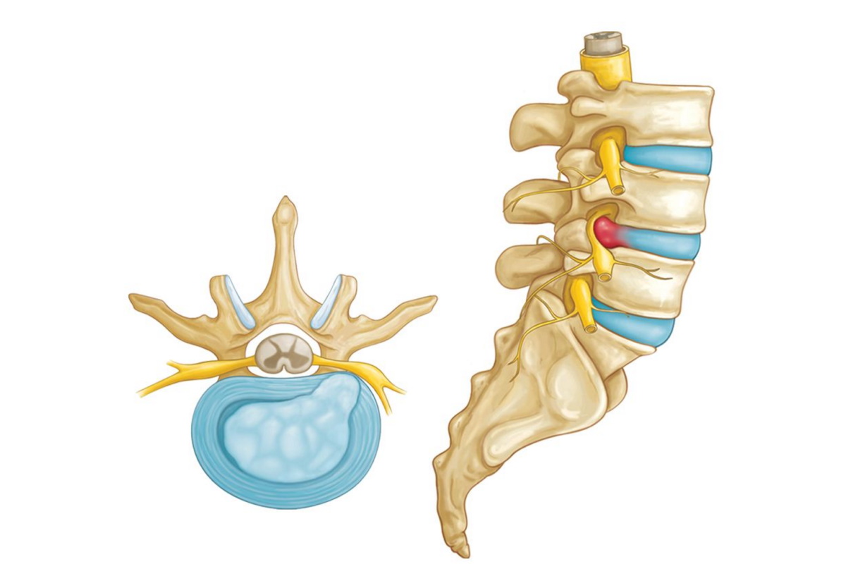 Cervical Spine Anatomy - ShimSpine